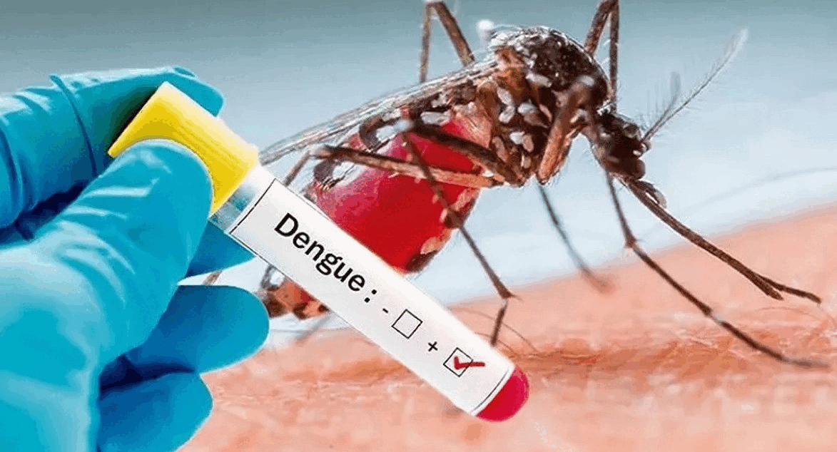 DIAGNÓSTICO Y MANEJO CLÍNICO DEL DENGUE