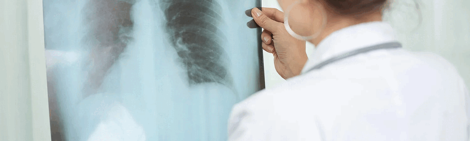 EPIDEMIOLOGÍA Y CONTROL DE LA TUBERCULOSIS EN TIEMPOS ACTUALES