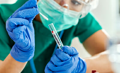 SALUD PUBLICA Y EPIDEMIOLOGIA