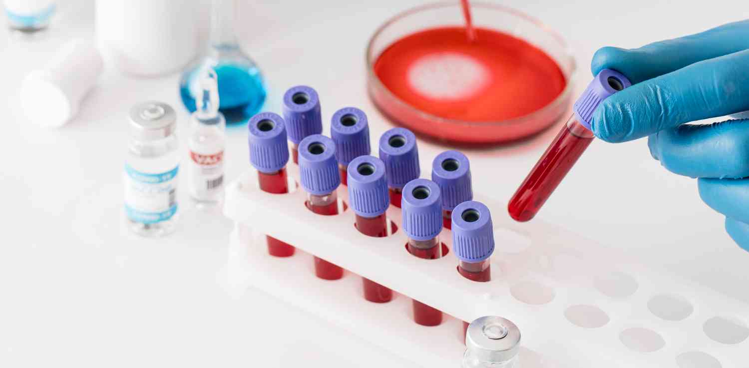 HEMATOLOGIA