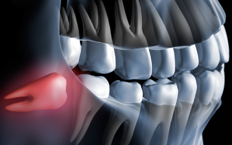 RADIOLOGÍA BUCAL Y MAXILOFACIAL
