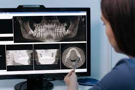 DIAGNÓSTICO POR IMÁGENES EN ODONTOLOGÍA