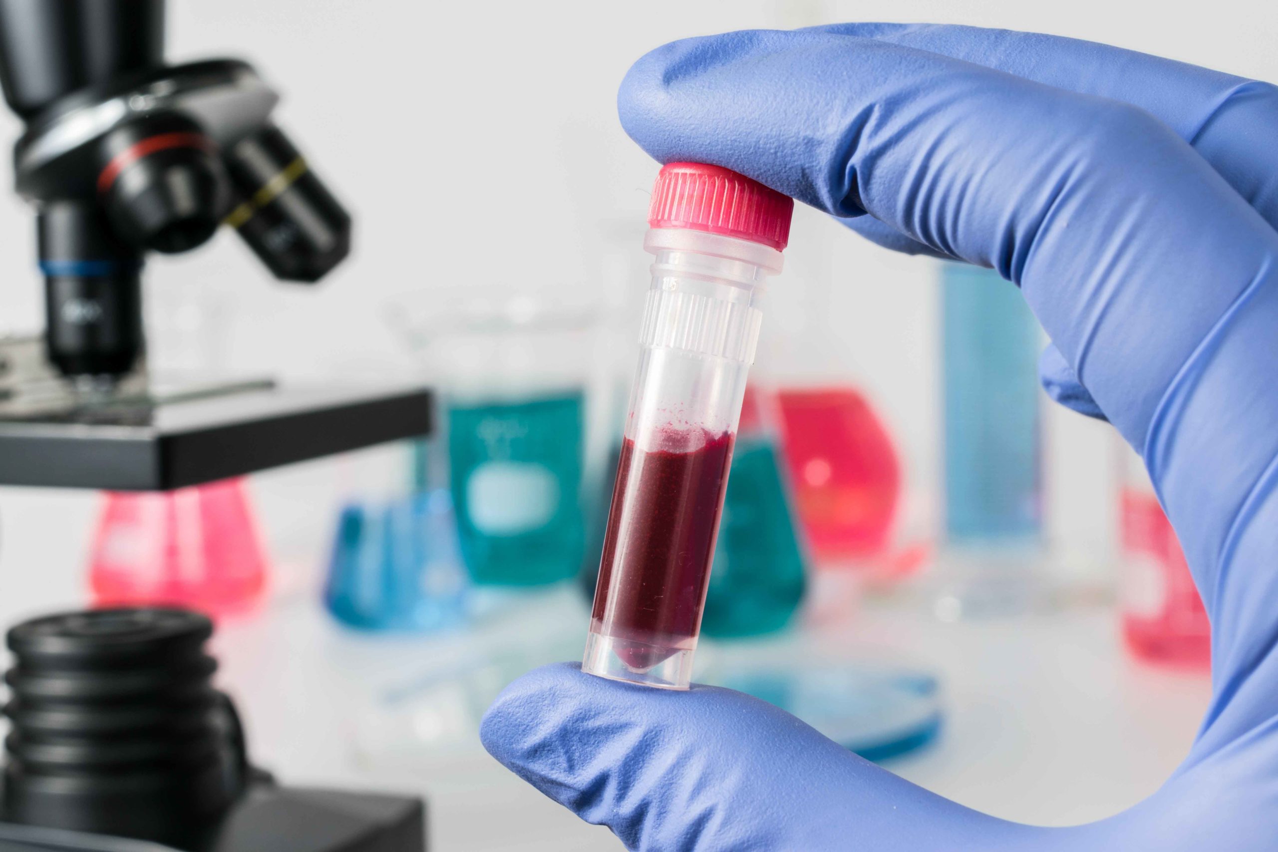 TÉCNICAS DE ANÁLISIS HEMATOLOGICO