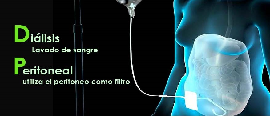 DIÁLISIS PERITONEAL