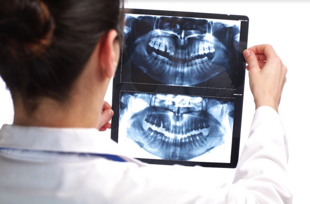 OPERACIÓN DE EQUIPOS DE RAYOS X DENTALES