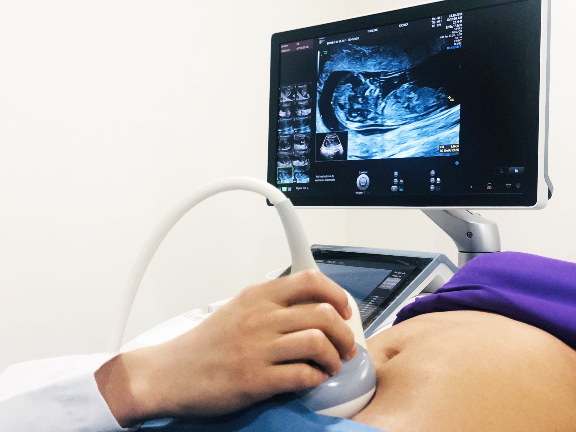 ULTRASONIDO OBSTÉTRICA Y MEDICINA MATERNO FETAL