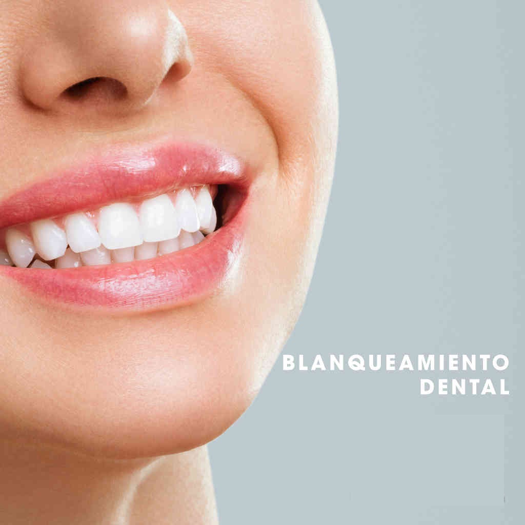 BLANQUEAMIENTO DENTAL