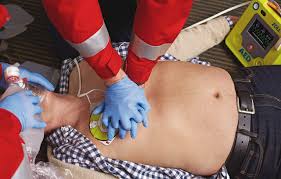 EMERGENCIAS CARDIOVASCULAR PULMONAR