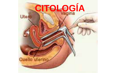 CITOLOGÍA DIAGNOSTICADA