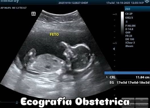 ECOGRAFÍA OBSTÉTRICA